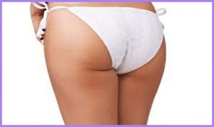 Sollevamento glutei Afragola