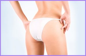 Sollevamento glutei Carrara